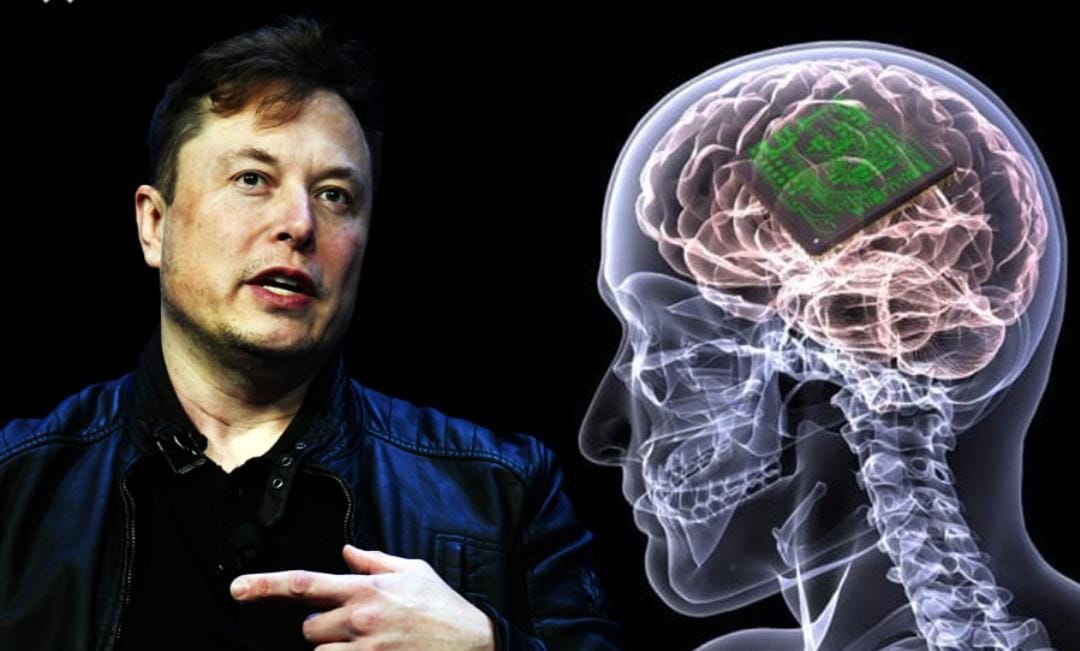 Elon Musk : ভাবনাকে বাস্তবে রূপান্তরিত করতে চলেছেন ইলন মাস্ক - West Bengal News 24
