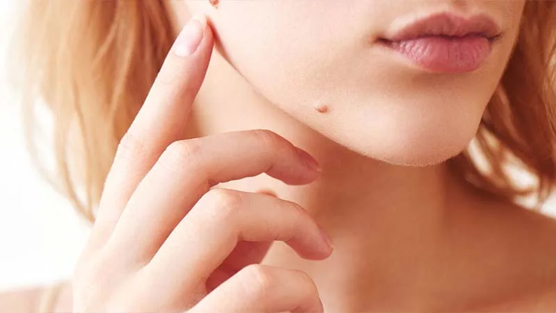 তিলের মধ্যেই লুকিয়ে আছে মরণব্যাধি রোগ! সতর্ক করলেন চিকিৎসক - West Bengal News 24