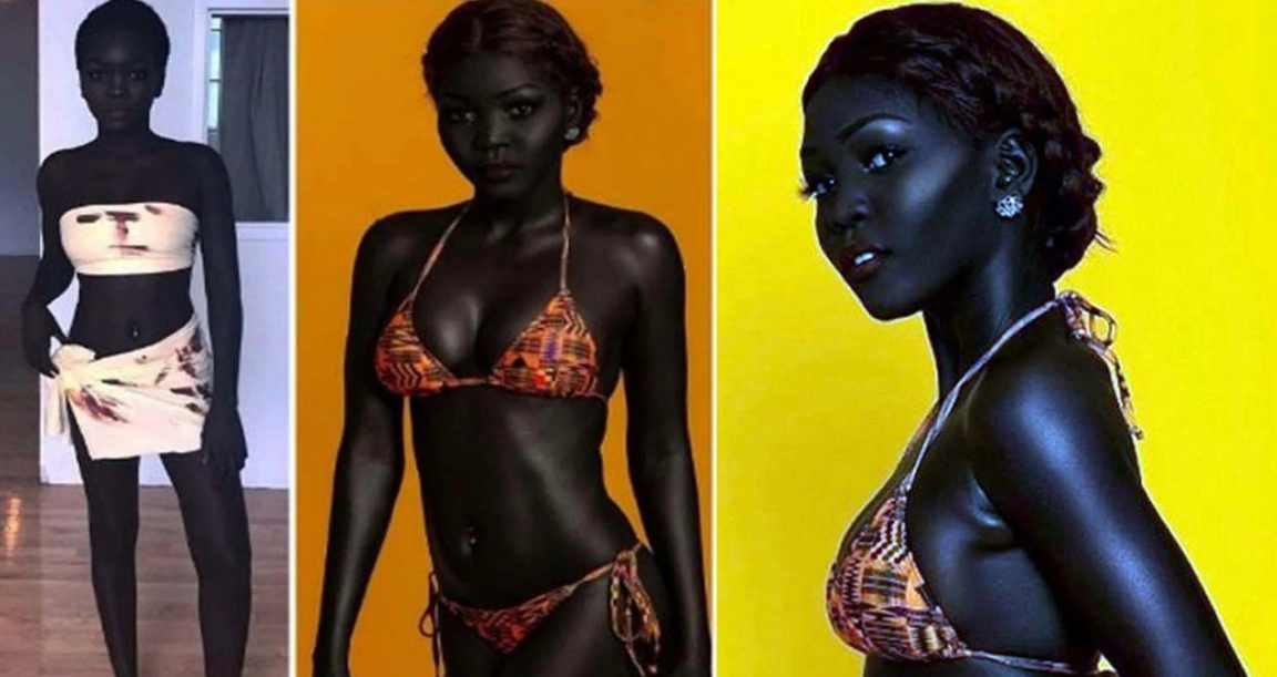 Nyakim Gatwech : শরীরের কালো রঙ দেখিয়েই কোটি কোটি টাকা ইনকাম - West Bengal News 24