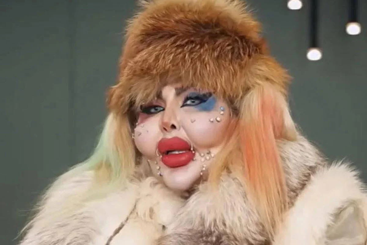 চেহারা সুন্দর করতে ৩৮৮ বার প্লাস্টিক সার্জারি, খরচ ৪৫০ কোটি টাকা - West Bengal News 24