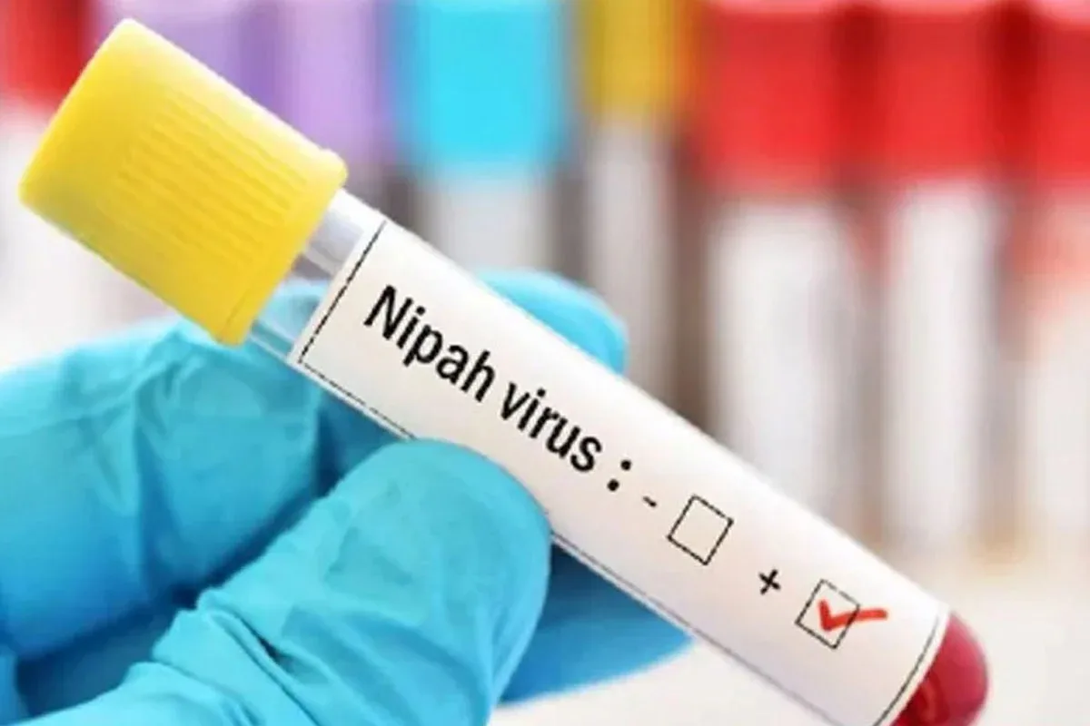 Nipah Virus : রাজ্যে নিপা আতঙ্ক বাড়ল, আরও দুই স্বাস্থ্যকর্মীর শরীরে উপসর্গ - West Bengal News 24 Nipah Virus : রাজ্যে নিপা আতঙ্ক বাড়ল, আরও দুই স্বাস্থ্যকর্মীর শরীরে উপসর্গ - West Bengal News 24